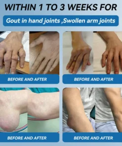 𝐋𝐢𝐩𝐌𝐚𝐩𝐬® BPC-157 Joint & Gout Relief Cream