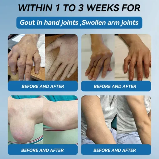 𝐋𝐢𝐩𝐌𝐚𝐩𝐬® BPC-157 Joint & Gout Relief Cream