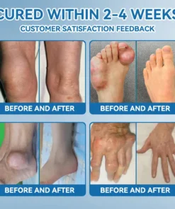 𝖯𝗂𝖼𝗱𝗼® BPC-157 Joint Healing Cream