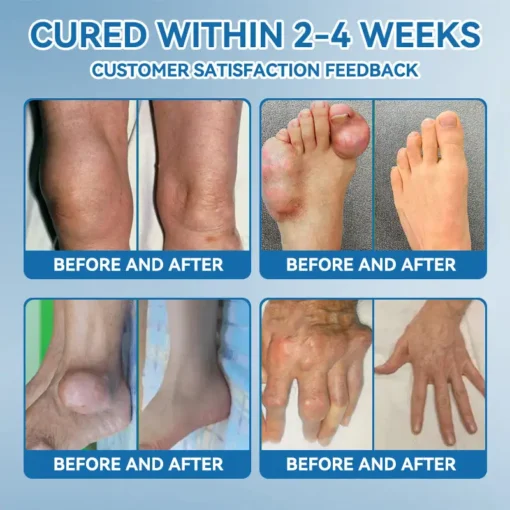 𝖯𝗂𝖼𝗱𝗼® BPC-157 Joint Healing Cream