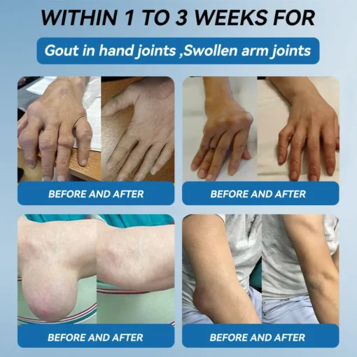 𝖯𝗂𝖼𝗱𝗼® BPC-157 Joint Healing Cream
